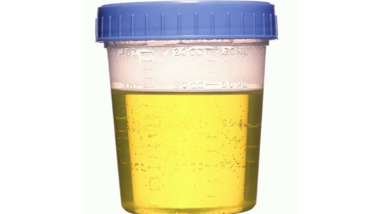 Urine Analysis Drug Test