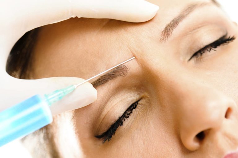 Recovery after a Botox Procedure