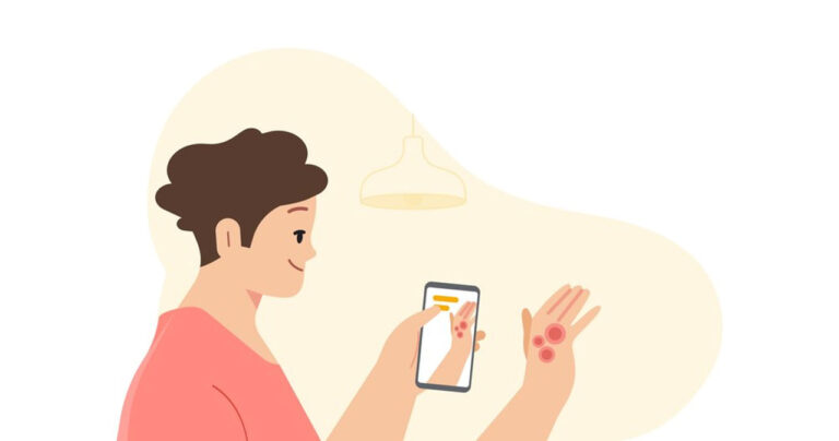 Google Previews AI-Powered applications to diagnose skin conditions